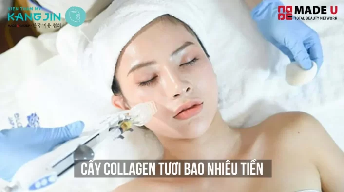 cấy collagen tươi bao nhiêu tiền
