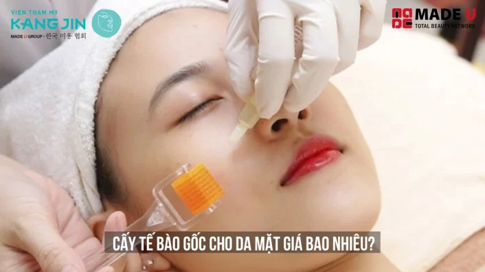 cấy tế bào gốc cho da mặt giá bao nhiêu