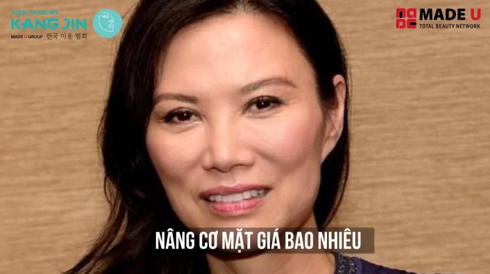 khắc phục gò má cao