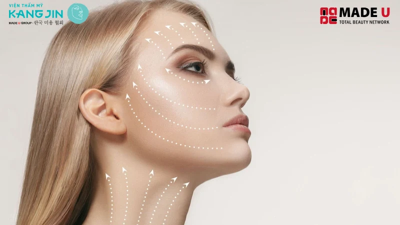 Phương pháp căng chỉ collagen giúp trẻ hóa da từ bên trong