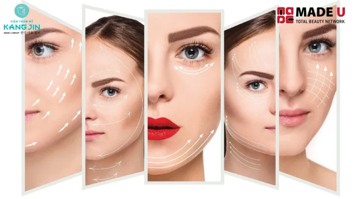 Căng chỉ collagen bao lâu trở lại bình thường