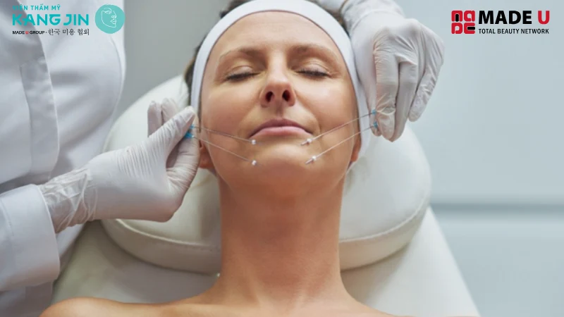 nếu bạn mong muốn trẻ hóa da nhanh chóng, không nghỉ dưỡng lâu thì nên cấy sợi collagen