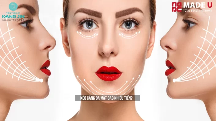Kéo Căng Da Mặt Bao Nhiêu Tiền