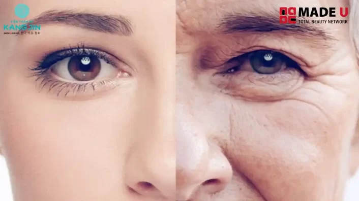 Cách Nâng Cơ Mặt Bị Chảy Xệ