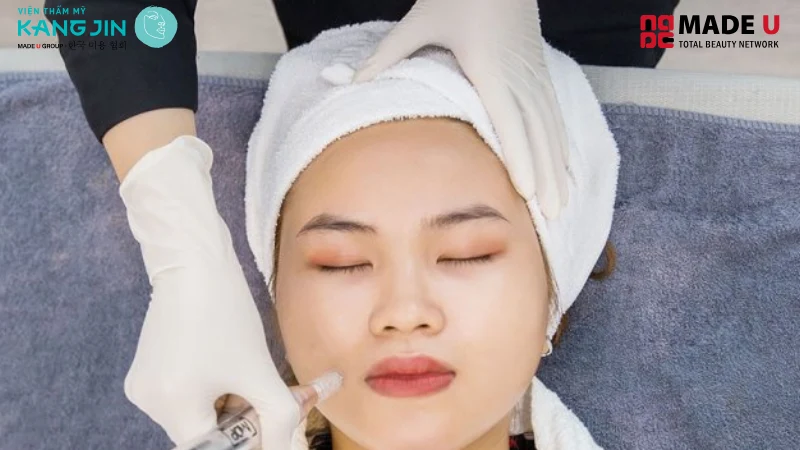 cấy collagen tươi giữ được khoảng 5- 7 năm