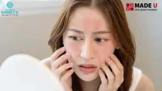 Cách chăm sóc da nhạy cảm: Routine chuẩn, sản phẩm nên dùng & điều cần tránh