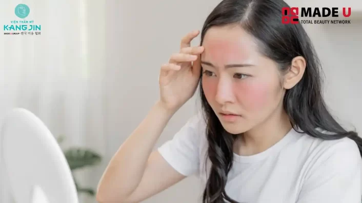 Cách chữa da bị cháy nắng tại nhà