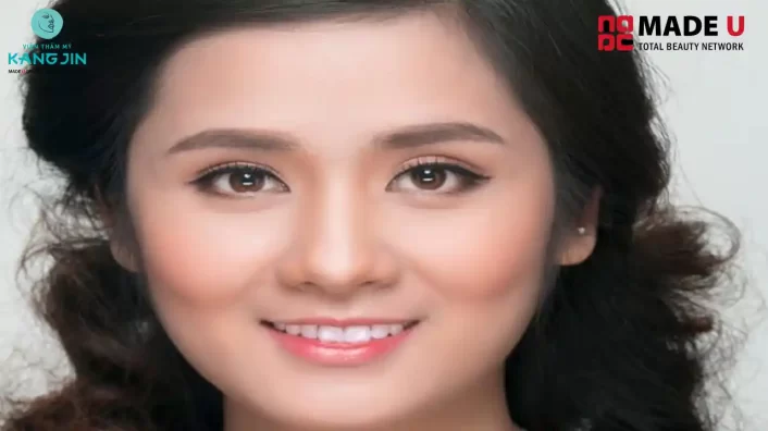 Cách xác định gò má cao hay thấp