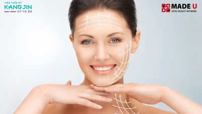 Các vùng có thể cấy chỉ như trán, khóe mắt để xóa nhăn