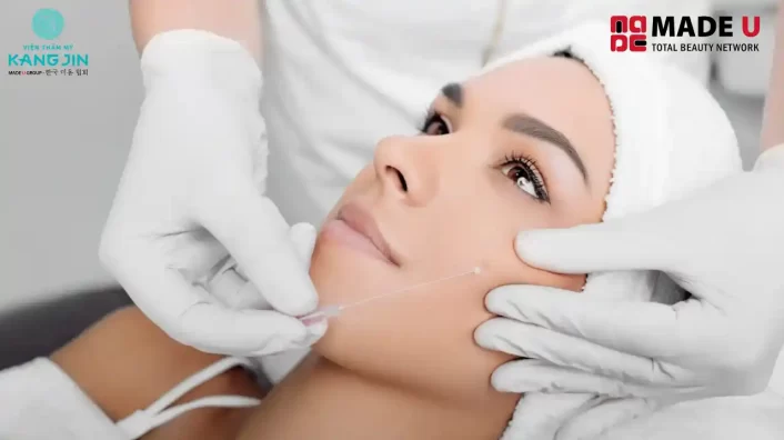 Cấy chỉ collagen là gì