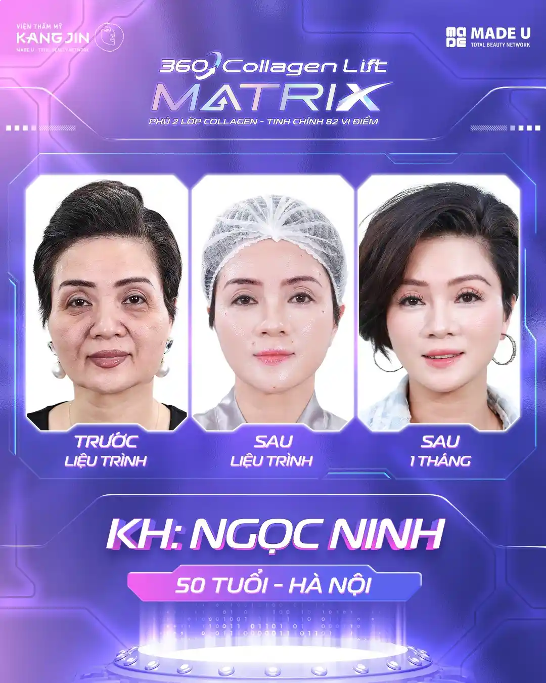 Ma Trận Trẻ Hoá 360 Collagen Lift Matrix