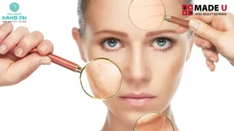 Tái tạo da lão hóa: Giải pháp cải thiện làn da chảy xệ, kém mịn màng