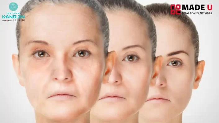 Trẻ hóa da mặt
