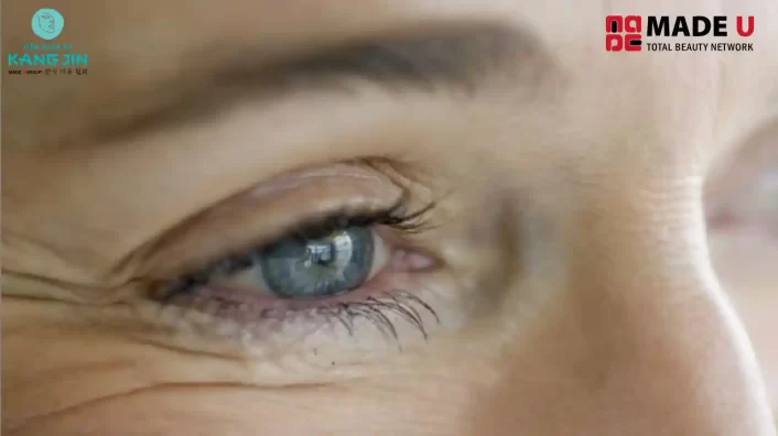 cách làm mờ nếp nhăn ở mắt