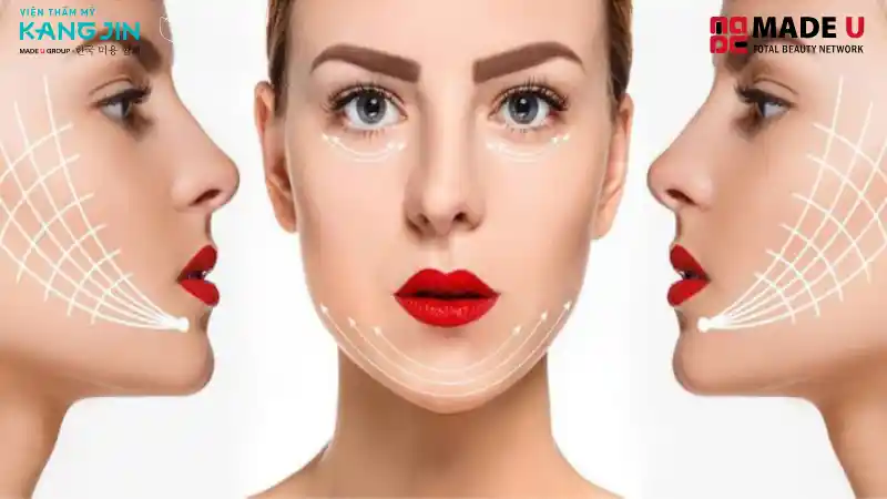 Cấy collagen có thể được ứng dụng ở vùng trán, thái dương, cổ, thậm chí cho hiệu quả cải thiện rãnh cười sâu hay má hóp.