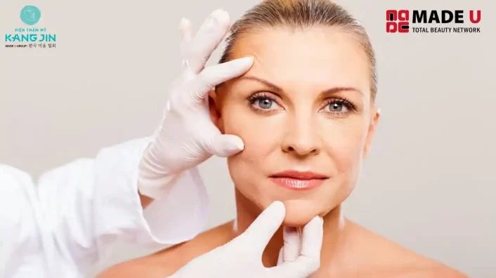 có nên nâng cơ mặt không