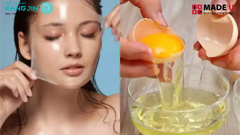 Trị nám bằng trứng gà giúp làm trắng và giảm vết nám hiệu quả