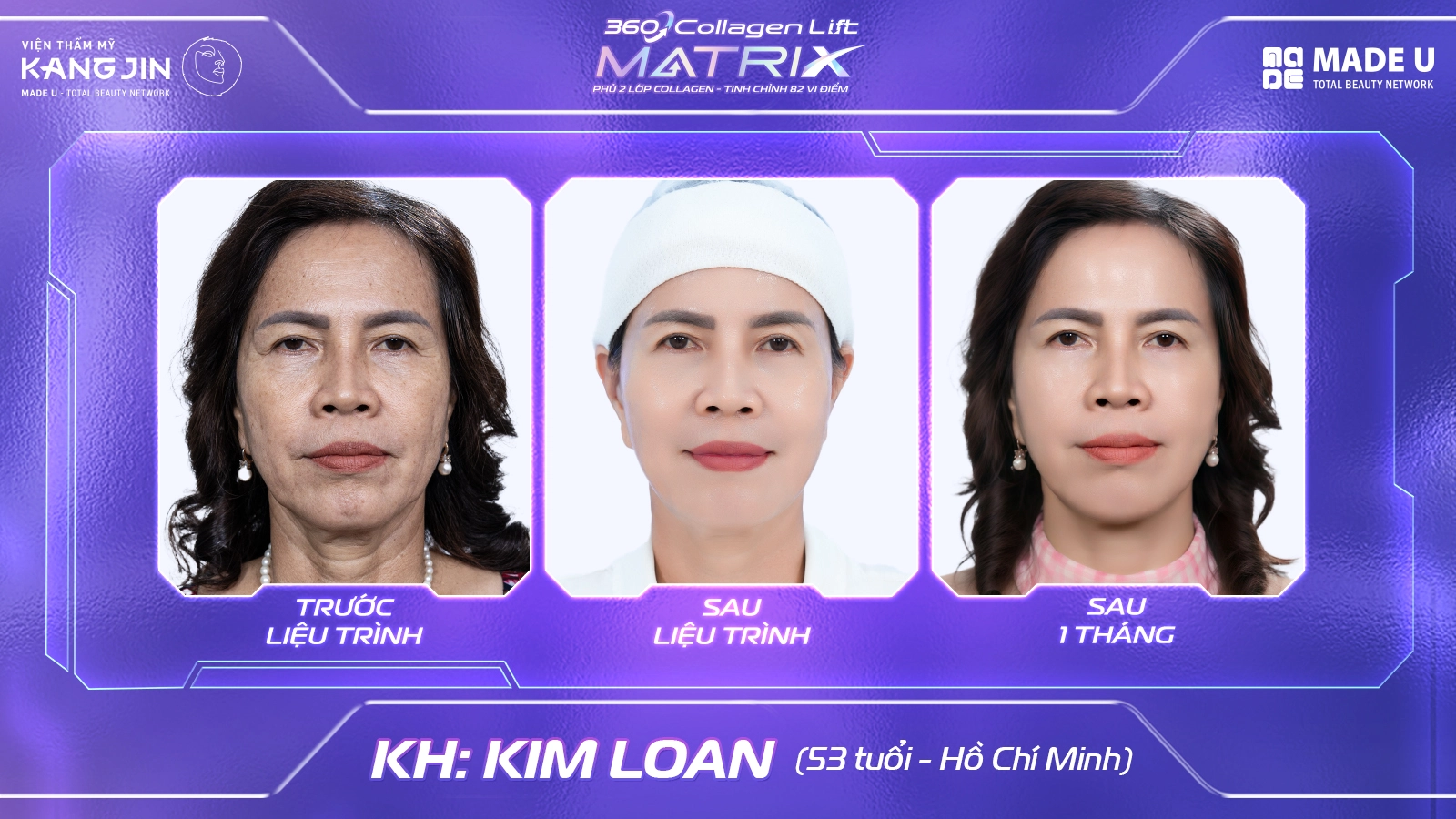 Collagen Lift Matrix 