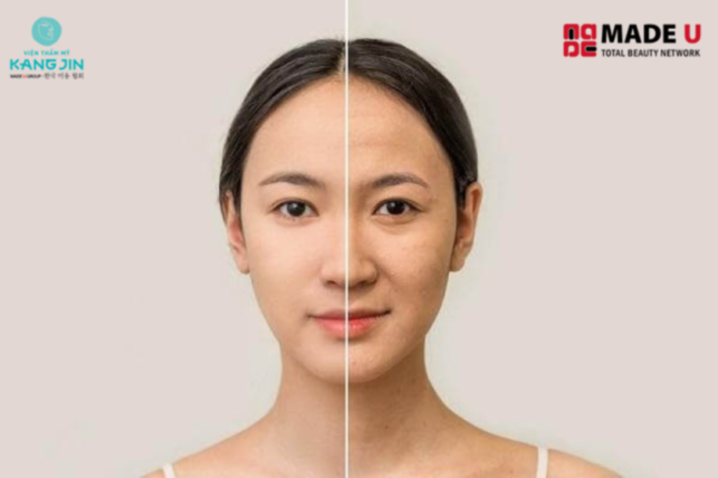 Da trước và sau khi mất đi độ đàn hồi