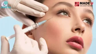 Liệu tiêm filler má hóp có tốt? – Giải pháp làm đầy gương mặt hốc hác an toàn hiệu quả 2025