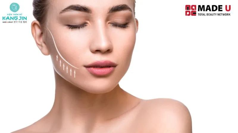 nâng cơ thon gọn mặt