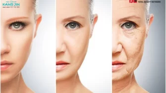 Chảy xệ cơ mặt – Nguyên nhân, dấu hiệu và cách khắc phục hiệu quả