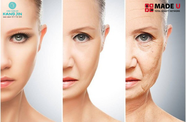 Dấu hiệu chảy xệ biểu hiện rõ mức độ lão hóa trên khuôn mặt