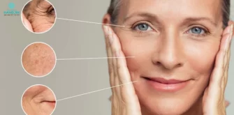 Nếp nhăn và vùng da chảy xệ hiện rõ trên khuôn mặt