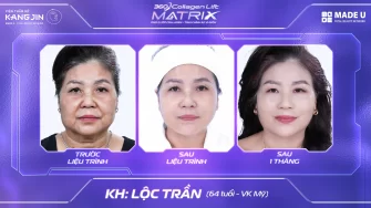 Trẻ hóa nâng cơ phục hồi hoàn toàn tại viện thẩm mĩ Kangjin