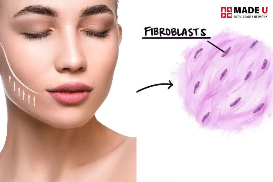 Cấy colllagen nguyên bào vào da bằng phương pháp không xâm lấn