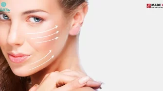 Collagen Nâng Cơ có thực sự hiệu quả và phổ biến ở Việt Nam