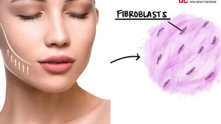 Cấy collagen nguyên bào không xâm lấn