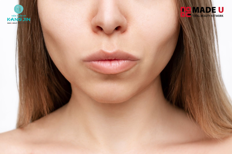 Nhiều nguyên nhân gây lên má hóp gây mấy thẩm mỹ ở phụ nữ