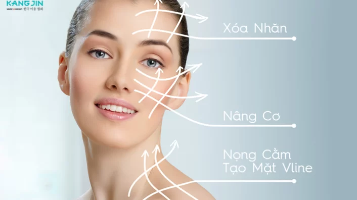 Một trong các phương pháp nâng cơ mặt được ưa chuộng nhất