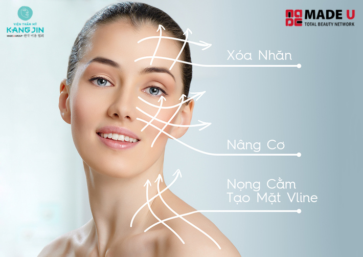 Một trong các phương pháp nâng cơ mặt được ưa chuộng nhất 