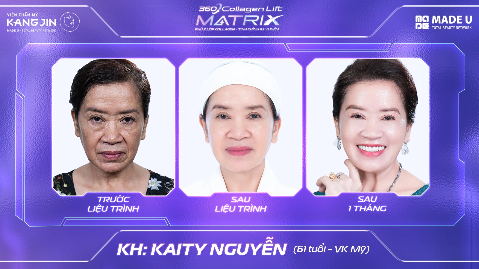 360 Collagen Lift Matrix