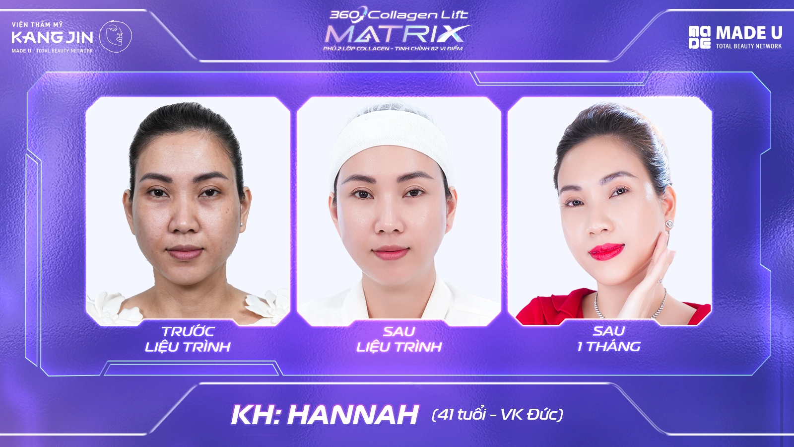 360 Collagen Lift Matrix