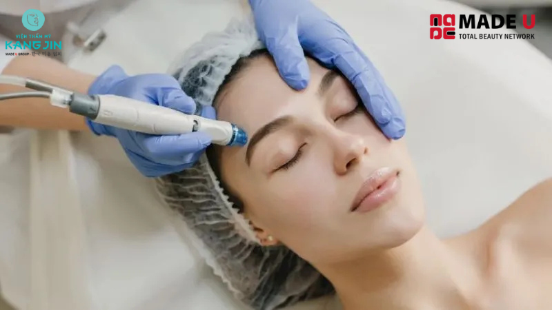 Quy trình cấy collagen chuẩn y khoa đảm bảo an toàn được nhiều người lựa chọn