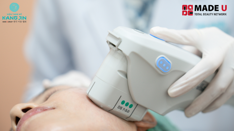 nâng cơ trẻ hoá hifu