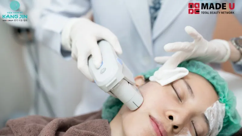 Chi phí căng da mặt Hifu còn phụ thuộc vào nhiều yếu tố