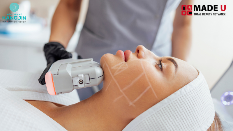 nâng cơ trẻ hoá hifu